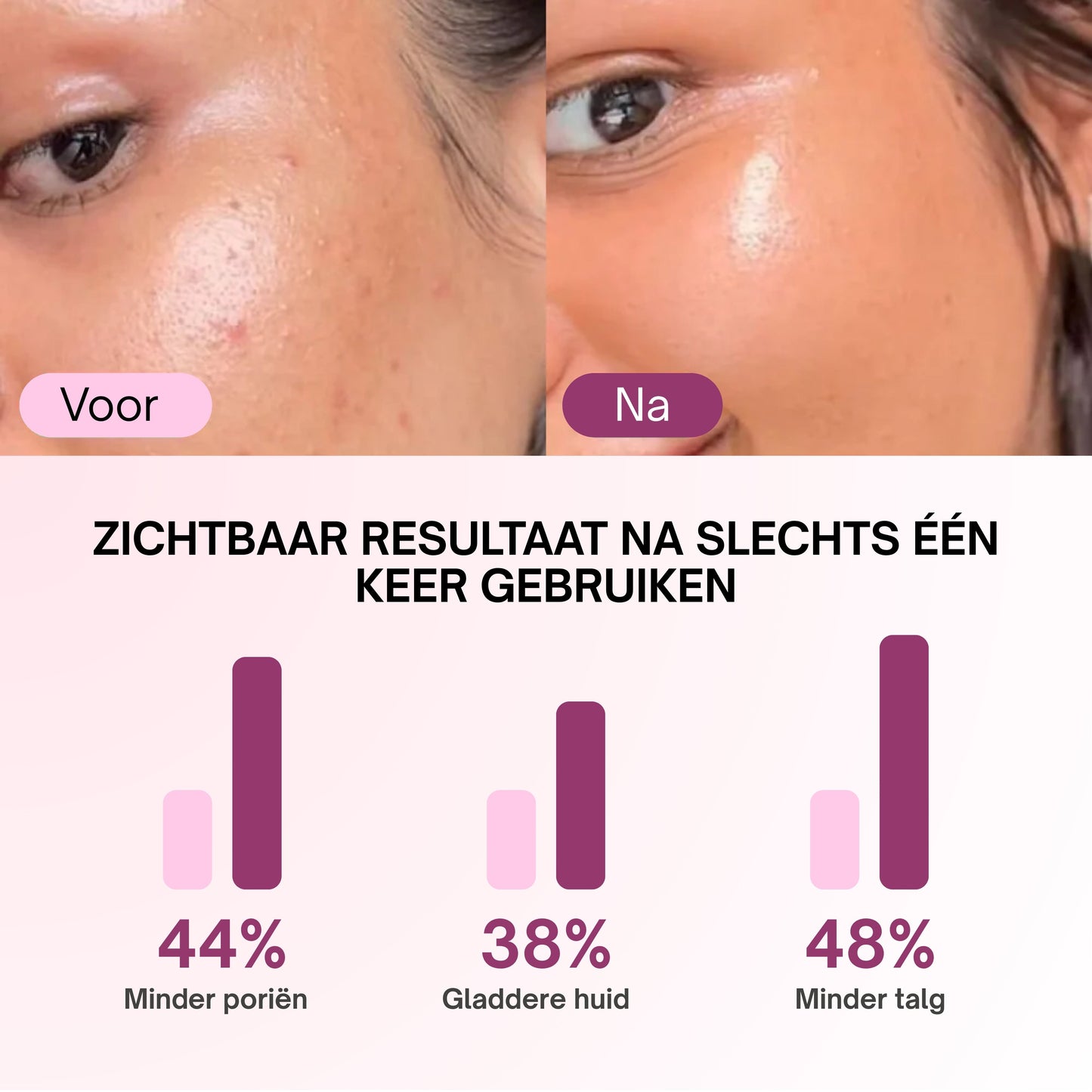Zero Pore Pads
