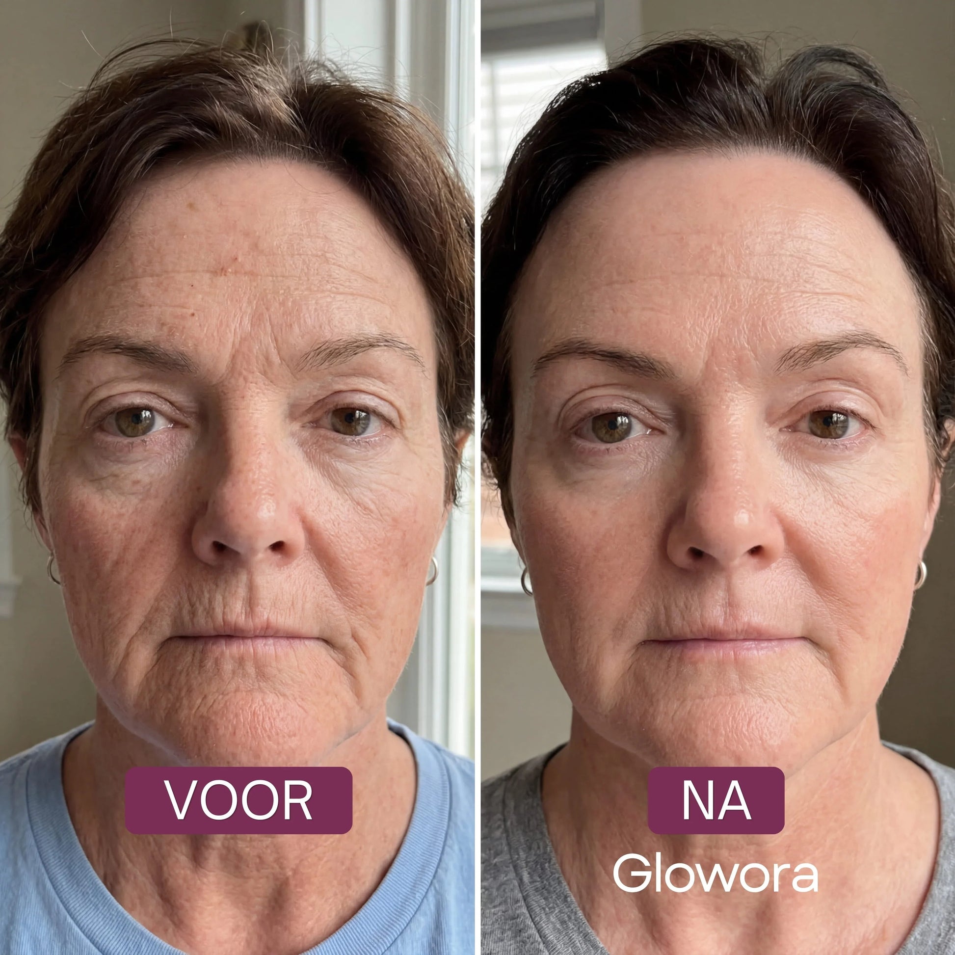 Slappe Hals Bio-Collageen Masker