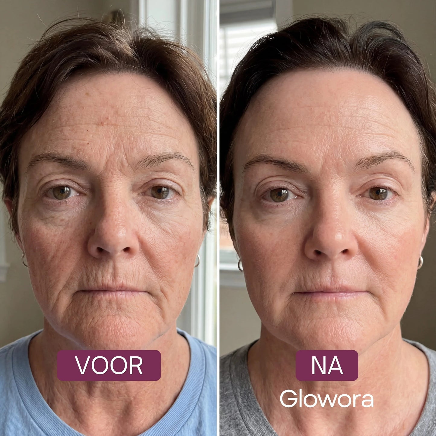 Bio-Collageen Masker.